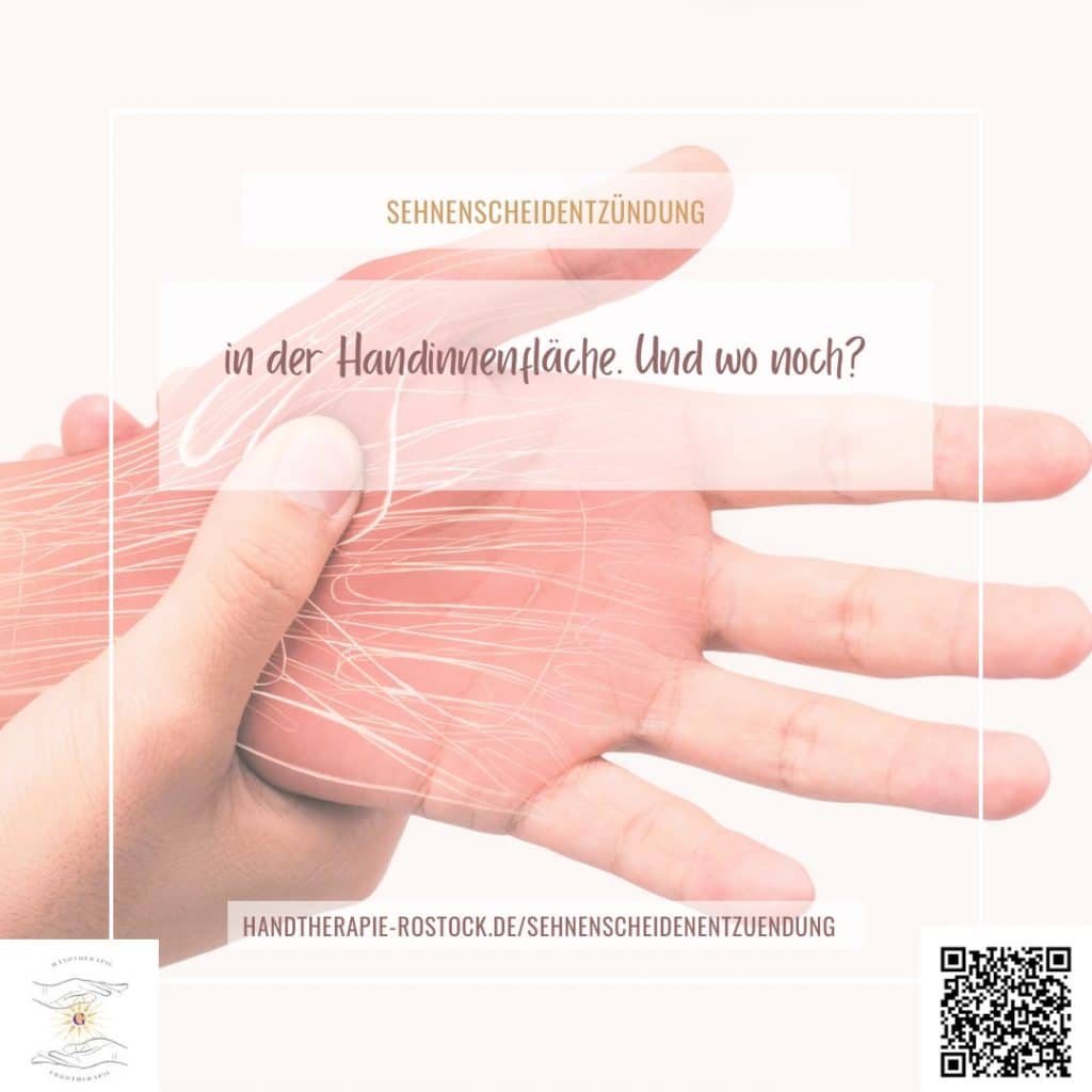 Sehnenscheiden Sehnenscheiden