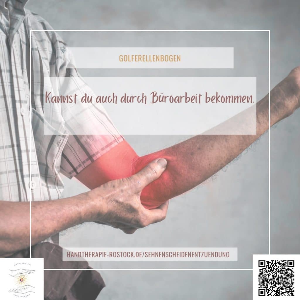 Was sind Sehnenscheiden Was sind Sehnenscheiden