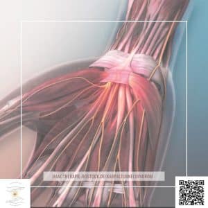 Karpaltunnelsyndrom Symptome