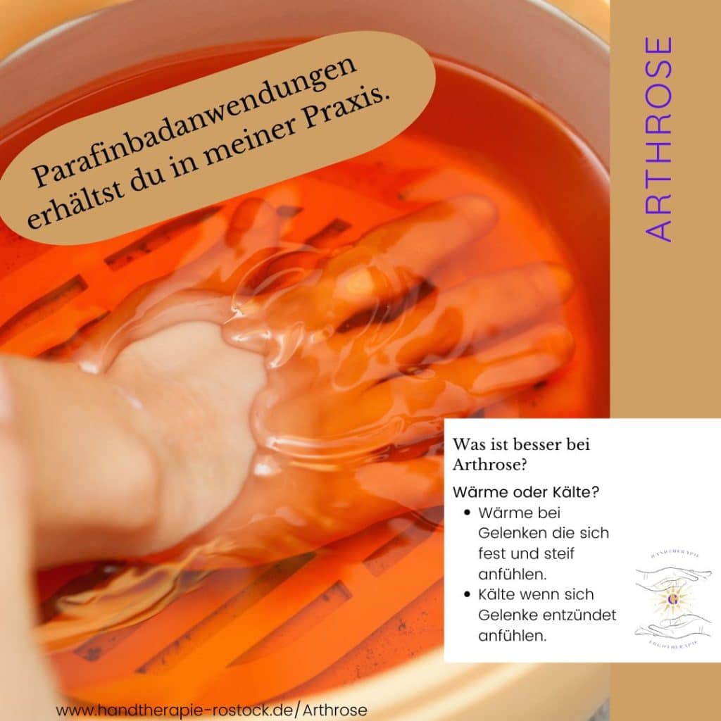 Arthrose Wärme oder Kälte
